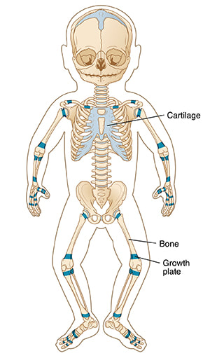 Babies are born with around 300 bones.