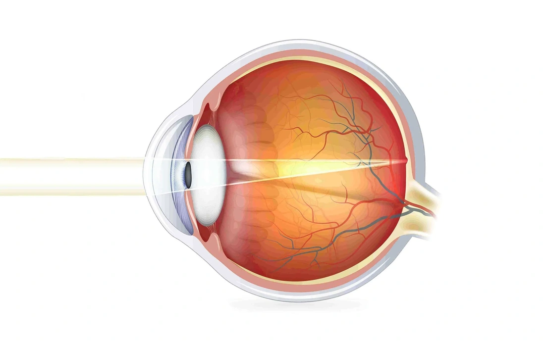 The cornea does not get oxygen from our blood